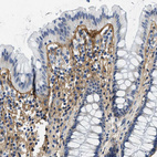 Immunohistochemical staining of human rectum shows moderate positivity in extracellular matrix of glandular cells.