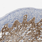 Immunohistochemical staining of human skin shows moderate positivity in extracellular matrix in dermis.