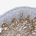 Immunohistochemical staining of human skin shows moderate positivity in extracellular matrix in dermis.