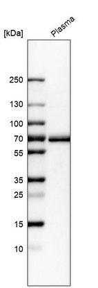 Western blot analysis in human plasma.