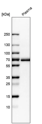 Western blot analysis in human plasma.