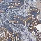 Anti-CLCA4 Antibody