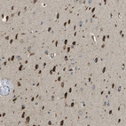 Immunohistochemical staining of human cerebral cortex shows moderate to strong cytoplasmic positivity in neurons.
