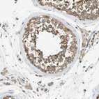 Immunohistochemical staining of human testis shows weak to moderate cytoplasmic positivity in cells in seminiferous ducts.