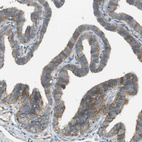 Immunohistochemical staining of human fallopian tube shows moderate to strong cytoplasmic positivity in glandular cells.