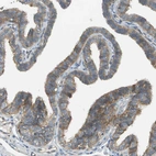 Immunohistochemical staining of human fallopian tube shows moderate to strong cytoplasmic positivity in glandular cells.