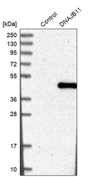 Anti-DNAJB11 Antibody