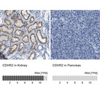 Anti-CDHR2 Antibody