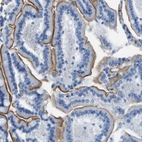 Immunohistochemical staining of human duodenum shows strong membranous positivity in glandular cells.