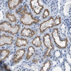 Immunohistochemical staining of human kidney shows strong membranous positivity in cells in tubules.