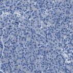 Anti-CDHR2 Antibody