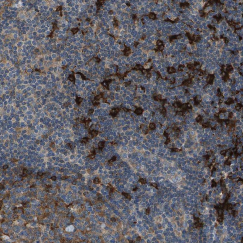 Anti-SAMSN1 Antibody
