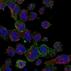 Immunofluorescent staining of human cell line REH shows localization to plasma membrane.