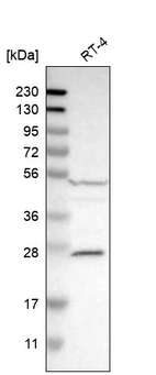 Western blot analysis in human cell line RT-4.