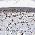 Immunohistochemical staining of human skin shows weak cytoplasmic positivity in epidermal cells.