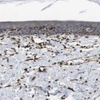 Immunohistochemical staining of human skin shows weak cytoplasmic positivity in epidermal cells.