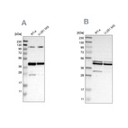 Western blot analysis using Anti-CFAP36 antibody HPA017061 (A) shows similar pattern to independent antibody HPA008994 (B).