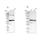 Western blot analysis using Anti-CFAP36 antibody HPA017061 (A) shows similar pattern to independent antibody HPA008994 (B).
