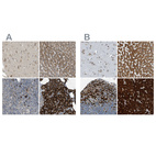 Anti-SSR1 Antibody