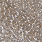 Immunohistochemical staining of human liver shows moderate granular cytoplasmic positivity in hepatocytes.