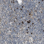 Immunohistochemical staining of human lymph node shows strong cytoplasmic positivity in subset of non-germinal center cells.