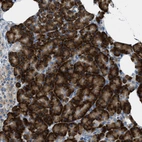 Immunohistochemical staining of human pancreas shows strong granular cytoplasmic positivity in exocrine glandular cells.