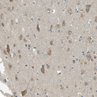 Anti-SSR1 Antibody