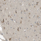 Immunohistochemical staining of human cerebral cortex shows moderate granular cytoplasmic positivity in neurons.