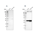 Western blot analysis using Anti-SSR1 antibody HPA017062 (A) shows similar pattern to independent antibody HPA011276 (B).