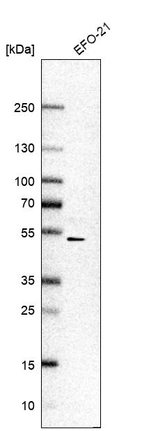 Western blot analysis in human cell line EFO-21.