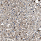 Anti-PNKD Antibody