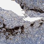 Immunohistochemical staining of human tonsil shows strong cytoplasmic positivity in squamous epithelial cells.