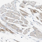 Immunohistochemical staining of human skeletal muscle shows weak cytoplasmic positivity in myocytes.
