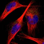 Immunofluorescent staining of human cell line U-251 MG shows localization to mitochondria.