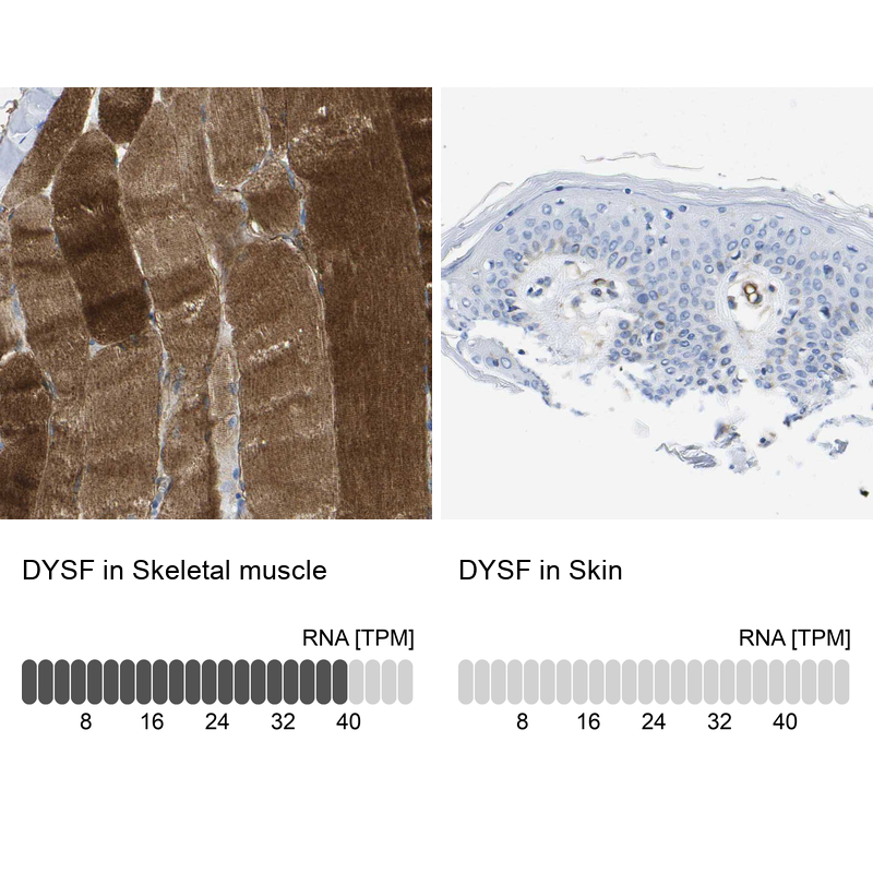 Anti-DYSF Antibody