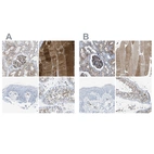 Immunohistochemical staining of human kidney, skeletal muscle, skin and testis using Anti-DYSF antibody HPA017071 (A) shows similar protein distribution across tissues to independent antibody HPA021945 (B).