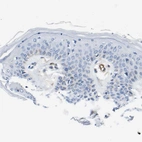 Immunohistochemical staining of human skin shows no positivity in squamous epithelial cells as expected.