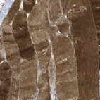 Immunohistochemical staining of human skeletal muscle shows strong cytoplasmic and membranous positivity in myocytes.