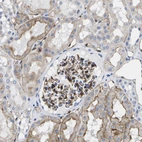 Immunohistochemical staining of human kidney shows moderate to strong membranous positivity in cells in glomeruli and cells in tubules.