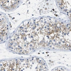 Immunohistochemical staining of human testis shows moderate membranous positivity in cells in seminiferous ducts.