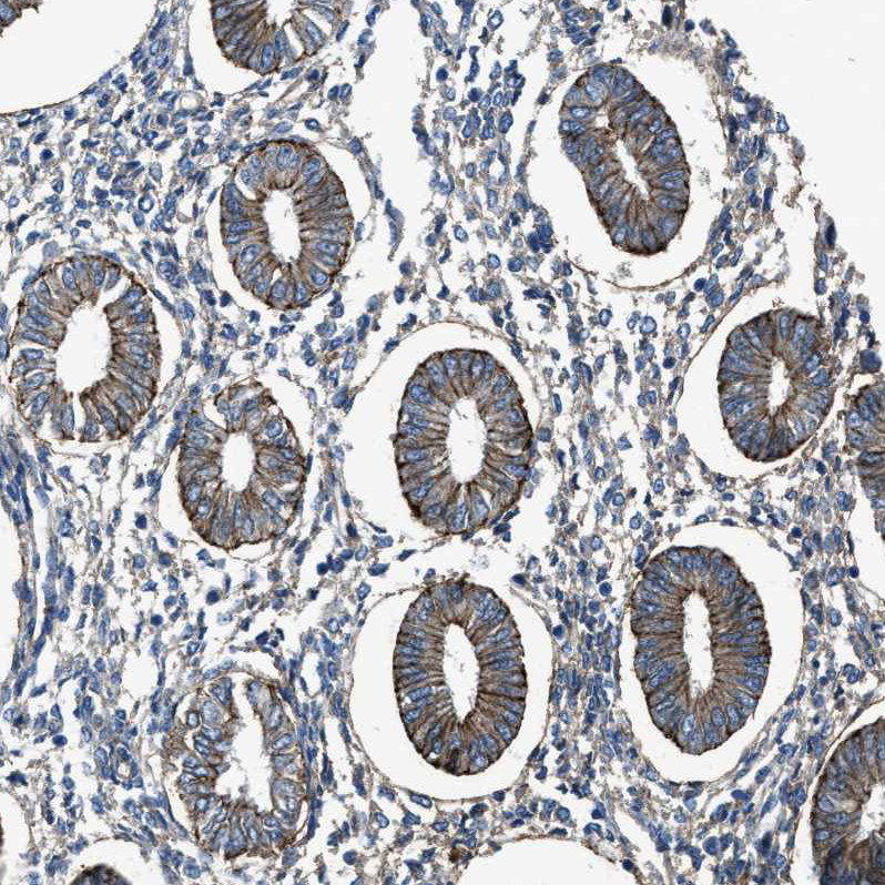 Anti-PTGFRN Antibody