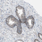 Immunohistochemical staining of human Prostate shows strong membranous positivity in glandular cells.