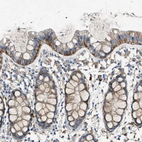 Immunohistochemical staining of human Rectum shows moderate membranous and cytoplasmic positivity in glandular cells.