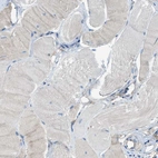 Immunohistochemical staining of human Skeletal muscle shows no positivity in myocytes as expected.