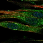 Immunofluorescent staining of human cell line ASC TERT1 shows localization to cytosol & the Golgi apparatus.