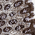 Immunohistochemical staining of human colon shows strong granular cytoplasm positivity in glandular cells.