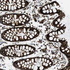 Immunohistochemical staining of human rectum shows strong granular cytoplasm positivity in glandular cells.