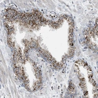 Immunohistochemical staining of human prostate shows strong granular cytoplasm positivity in glandular cells.