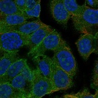 Anti-CEMIP2 Antibody