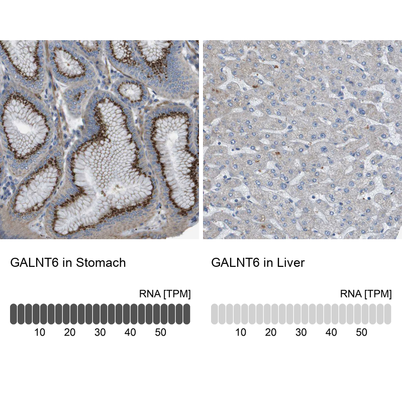 Anti-GALNT6 Antibody